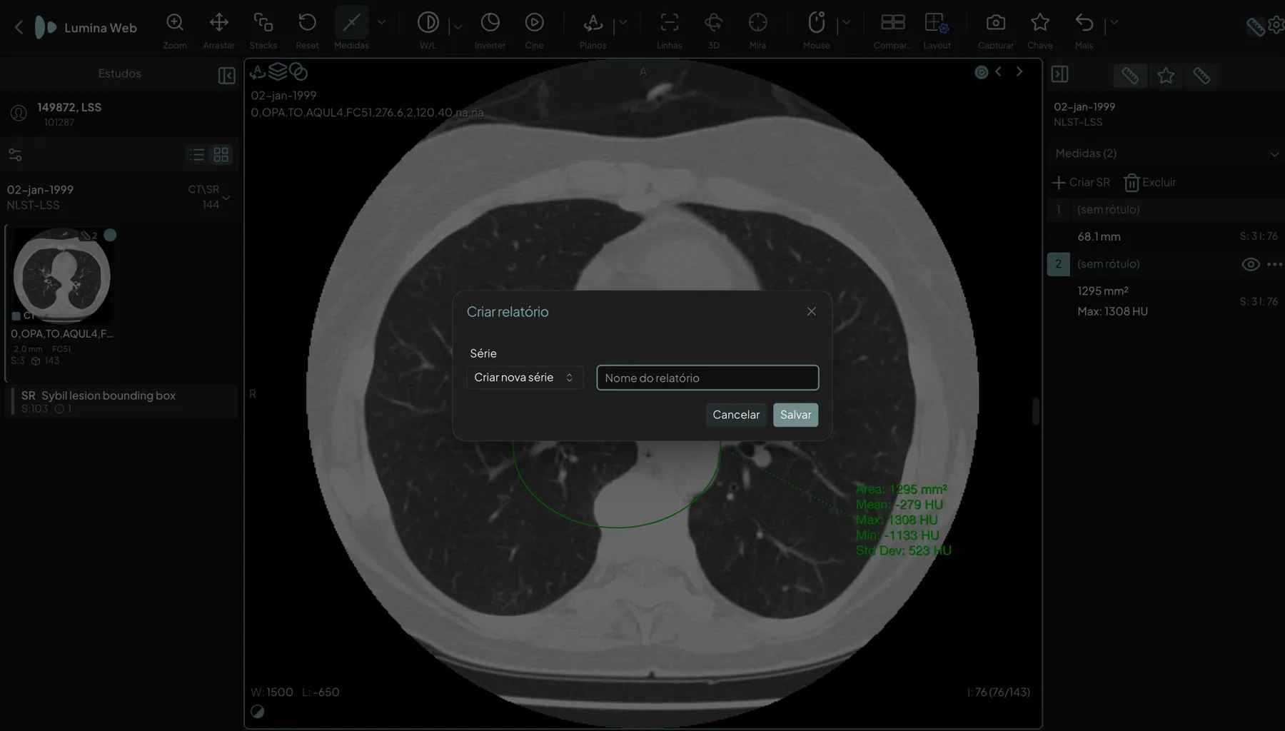 Lumina Web com duas medidas sobre uma tomografia de tórax, o painel Medidas à direita e o diálogo Criar relatório aberto para gravar o laudo estruturado