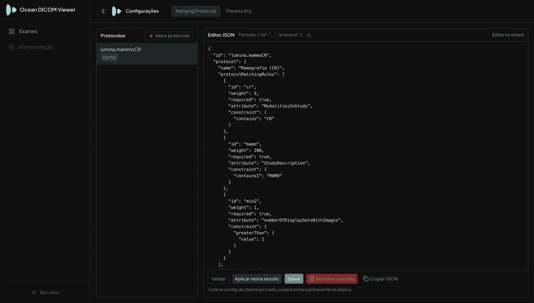 Editor avançado do protocolo de mamografia na área de Configurações, com a etiqueta config indicando que veio da configuração do cliente e os botões Validar, Aplicar nesta sessão, Salvar, Remover override e Copiar