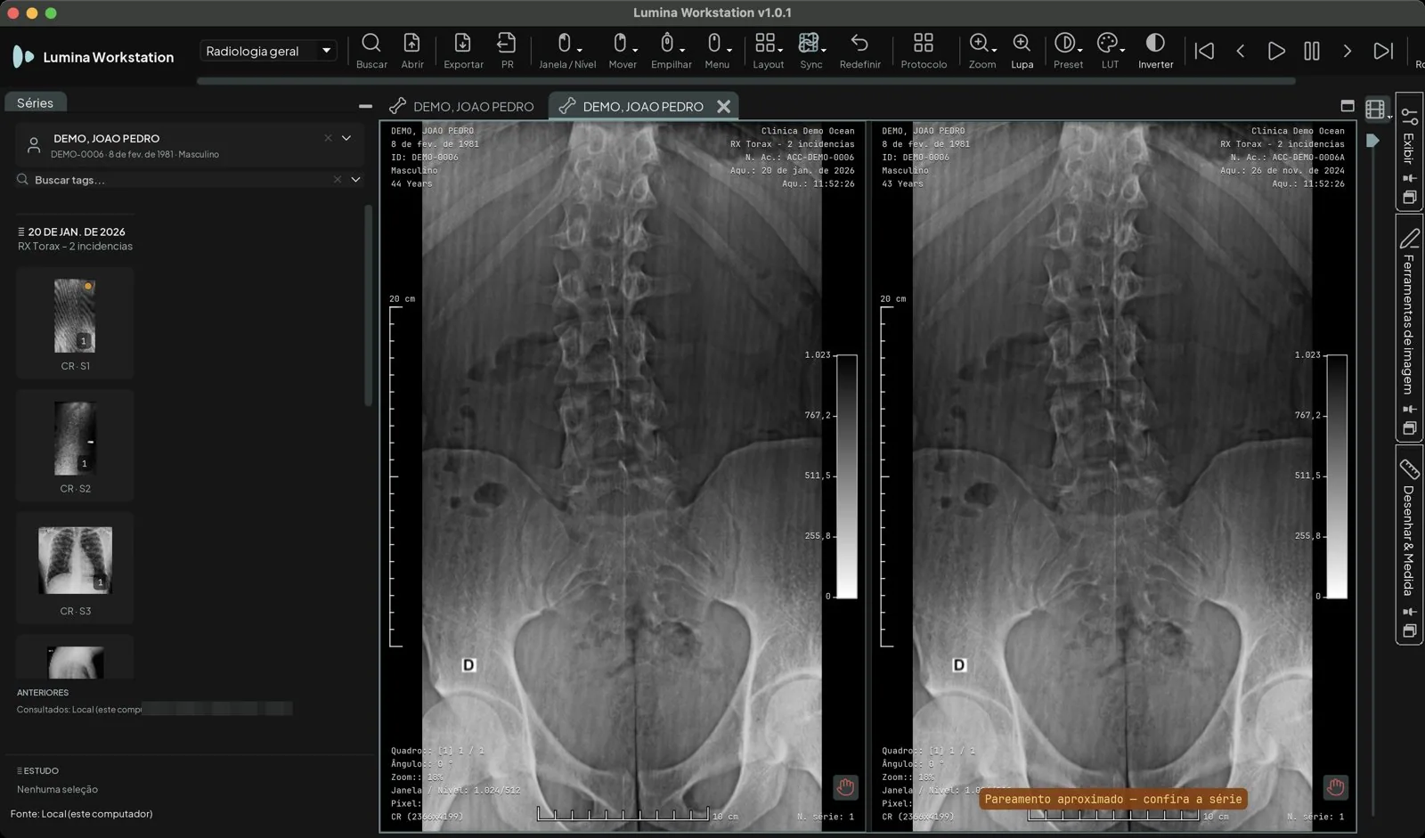 Radiografia atual e exame anterior lado a lado, com um aviso em laranja de pareamento aproximado sobre a imagem do anterior, pedindo para conferir a série