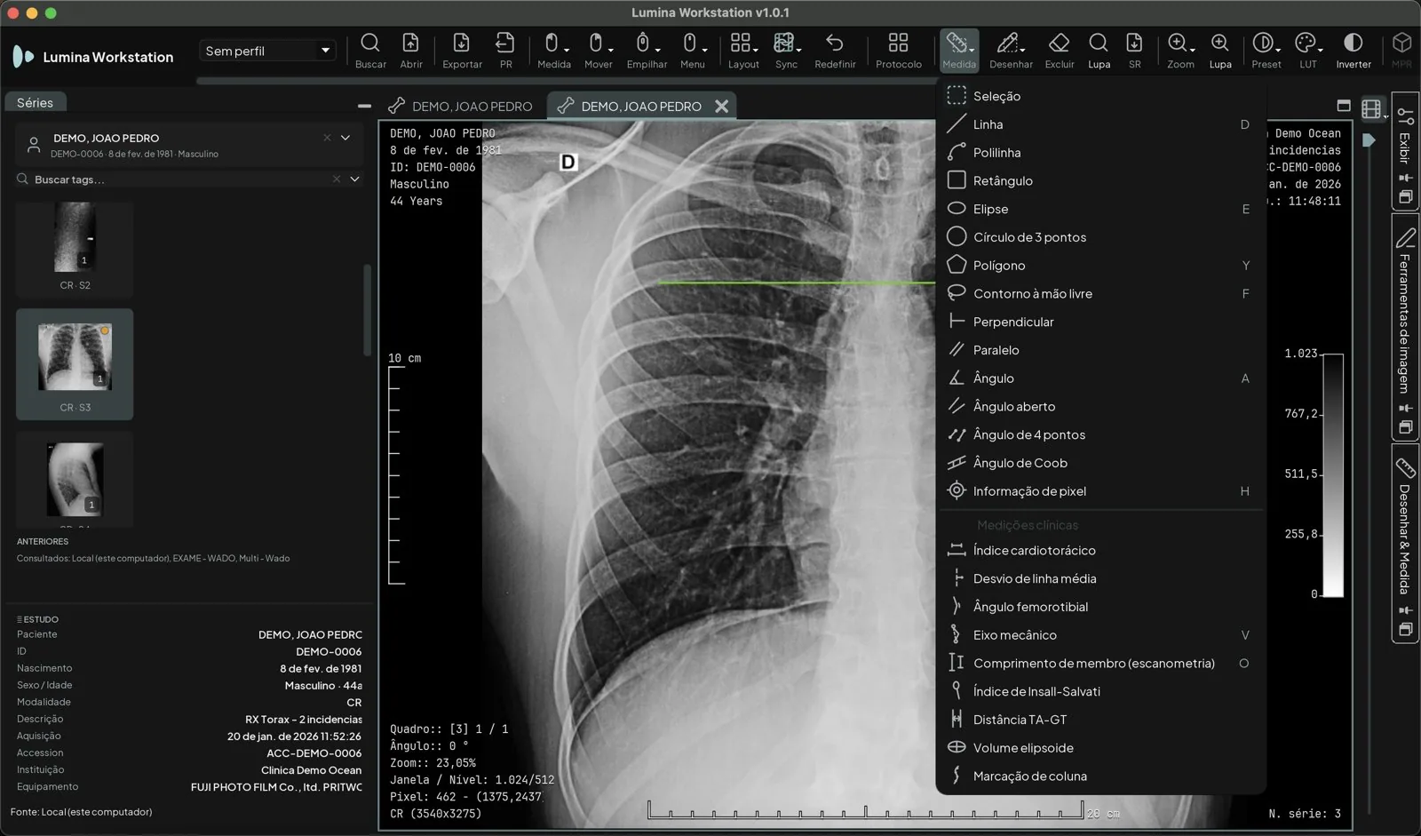 Menu Medida aberto com as ferramentas geométricas, de linha a informação de pixel, e o grupo Medições clínicas: índice cardiotorácico, desvio de linha média, ângulo femorotibial, eixo mecânico, escanometria, Insall-Salvati, distância TA-GT, volume elipsoide e marcação de coluna