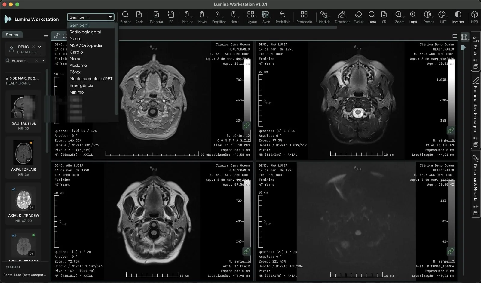 Seletor de perfil de barra aberto sobre a RM de crânio, listando os perfis de fábrica: Radiologia geral, Neuro, MSK / Ortopedia, Cardio, Mama, Abdome, Tórax, Medicina nuclear / PET, Emergência e Mínimo